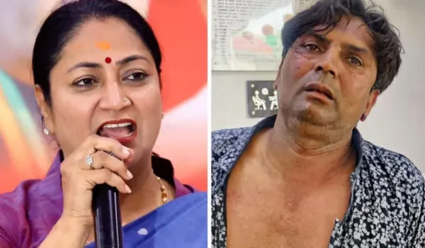 हाथ, कंधे और सिर पर चोटें आईं, आरोपी अरेस्ट