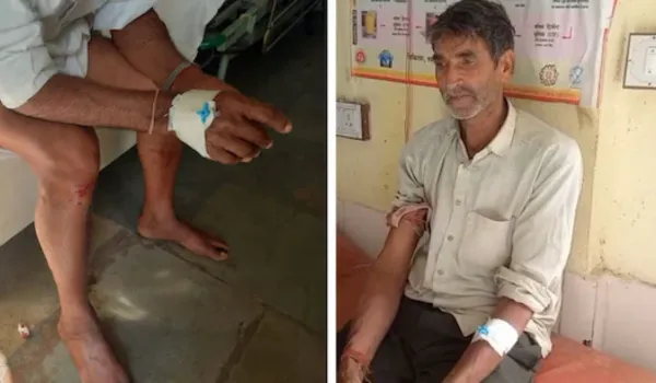 खेत में लेपर्ड ने दो किसानों पर किया हमला, घायल