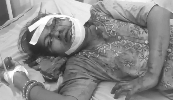 दामाद ने रॉड से हमला कर की सास की हत्या, पत्नी घायल