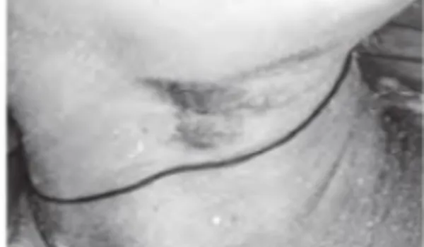 पांच बेटियां होने पर ससुराल वालों ने घोंट दिया बहू का गला