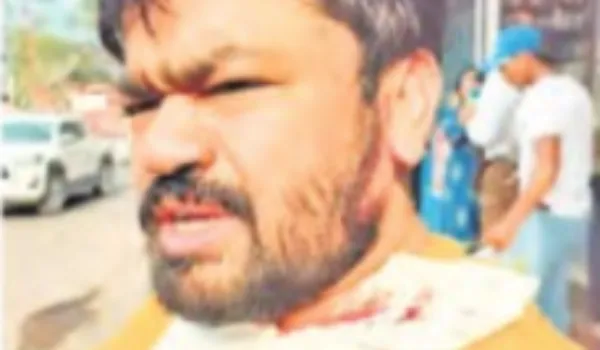 दरगाह को लेकर याचिका लगाने वाले विष्णु पर हमला