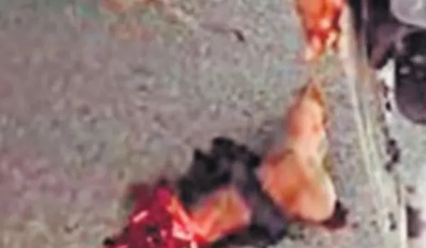 ट्रक ने 4 को रौंदा, दो के पैर कटकर हुए अलग... पहिये में फंसे